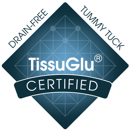 TissuGlu Badge